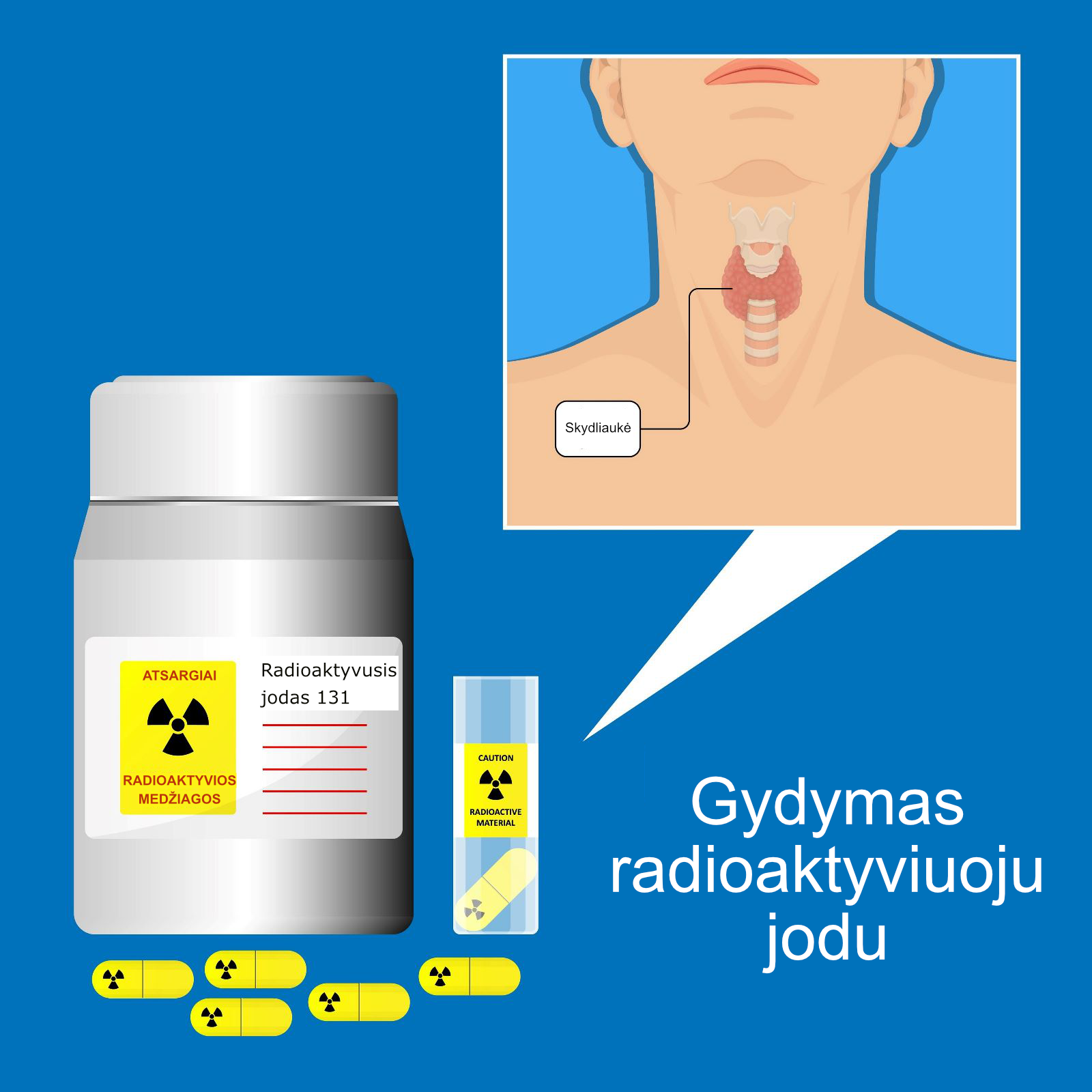 Radioactive iodine capsules help to transport the radioactive iodine to the Thyroid gland, where they destroy the pathological tissue of the Thyroid Gland.